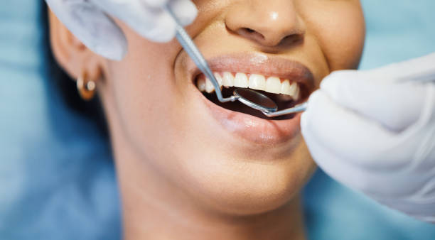 Best Emergency Dentist for Lost Fillings or Crowns in Tappahannock, VA