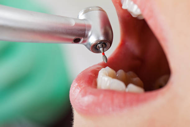 Best Weekend Emergency Dentist in Tappahannock, VA